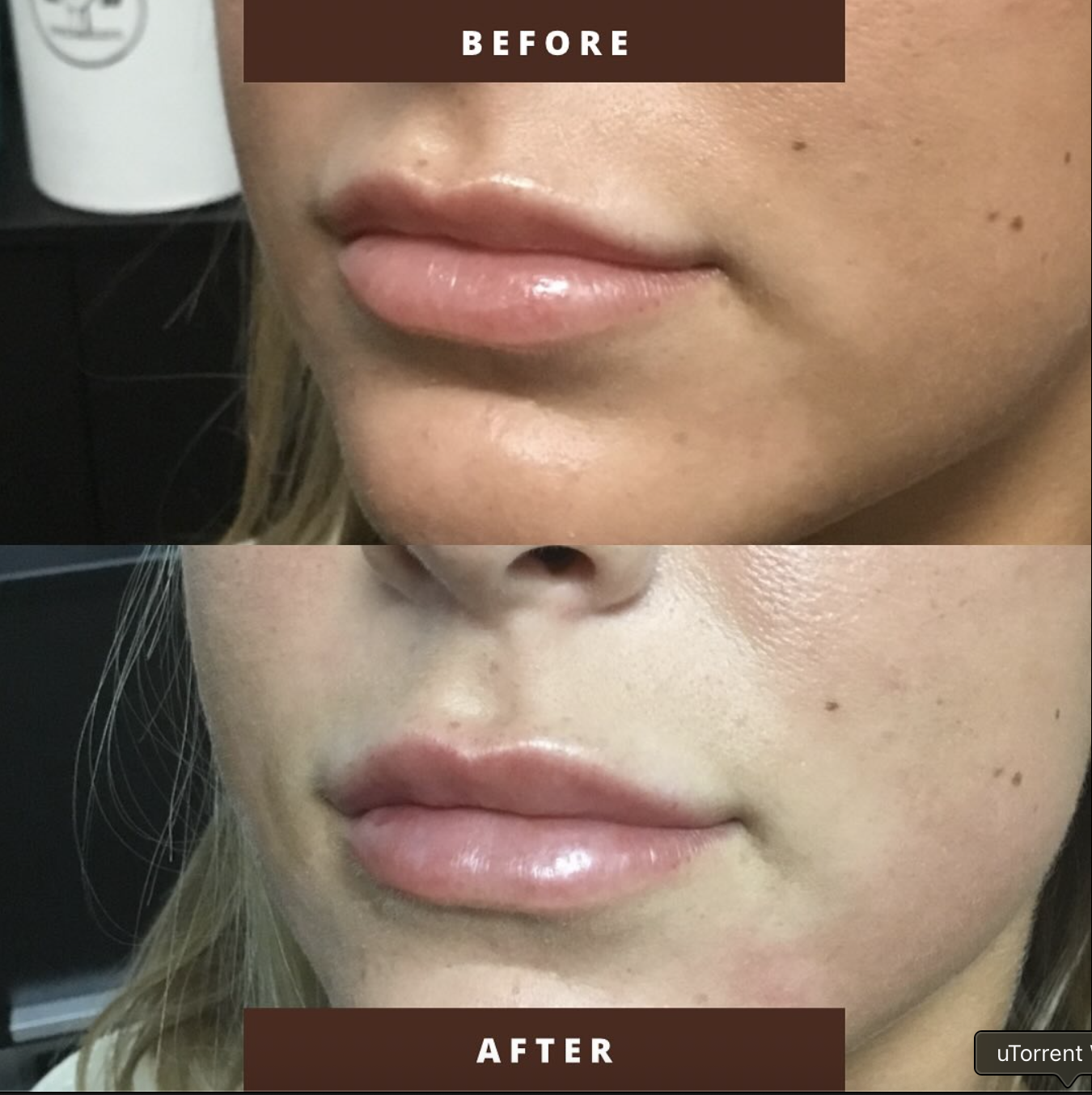 Before and after result 5