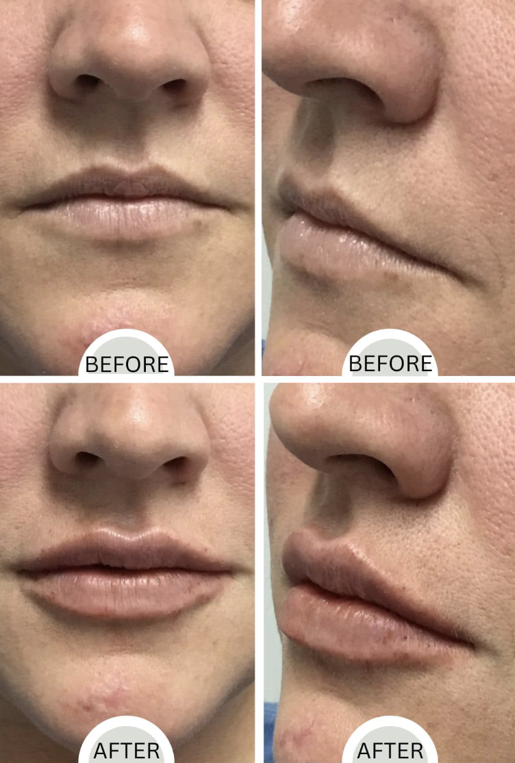Before and after result 6